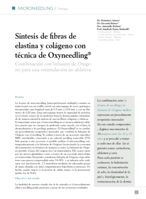 oxyxtra_med_oxyneedling